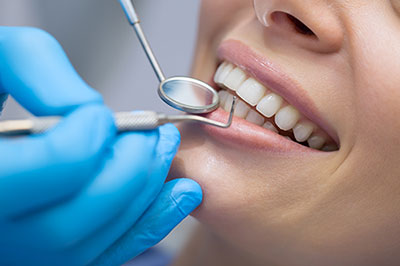 A dental professional performing a teeth cleaning procedure on a patient s mouth, with the patient smiling and wearing protective gloves.