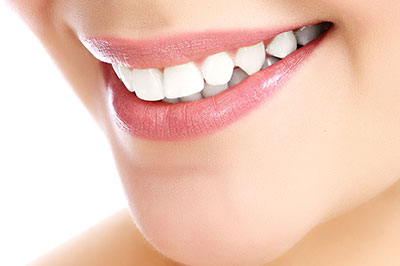 The image shows a close-up of a person s face, focusing on their smile with white teeth.