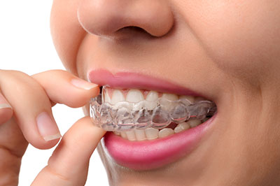 A person with a smile, holding their teeth in their hand while wearing a clear orthodontic appliance.