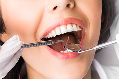 A woman with a mouth open, receiving dental treatment with a drill in her mouth.