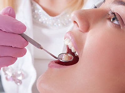 The image shows a dental professional performing a procedure on a patient s mouth, with the patient s teeth being cleaned or worked on.